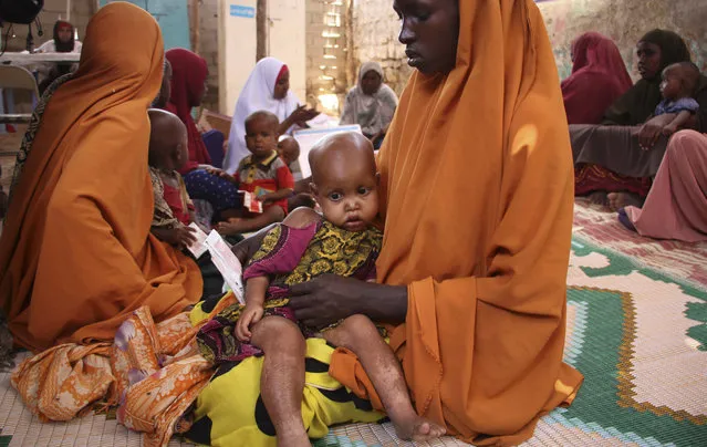 In this photo taken Saturday, March 25, 2017, a Somali woman holds her child Dahabo Sheikh Mumin, 1, as they attend a health center in Baidoa, Somalia. Somalia's drought is threatening 3 million lives according to the U.N. and in recent months aid agencies have been scaling up their efforts but say more support is urgently needed to prevent the crisis from worsening. (Photo by Farah Abdi Warsameh/AP Photo)