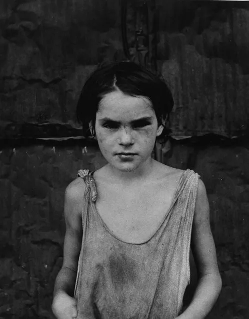 "Damaged Child, Shacktown, Elm Grove, Oklahoma," by American photographer, Dorothea Lange, 1936. (Photo by Dorothea Lange)