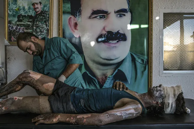 “IS Fighter Treated at Kurdish Hospital”. General News, first prize singles. Mauricio Lima, Brazil, The New York Times. Location: Hasaka, Syria. A doctor rubs ointment on the burns of Jacob, a 16-year-old Islamic State fighter, in front of a poster of Abdullah Ocalan, the jailed leader of the Kurdistan Workers' Party, at a Y.P.G. hospital compound on the outskirts of Hasaka, Syria, August 1, 2015. (Photo by Mauricio Lima/World Press Photo Contest)