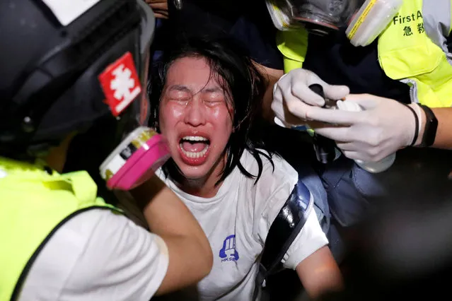 An anti-extradition bill protester receives medical attention after tear gas and pepper spray was used by riot police during a protest, outside Mong Kok police station, in Hong Kong, China on September 2, 2019. (Photo by Tyrone Siu/Reuters)