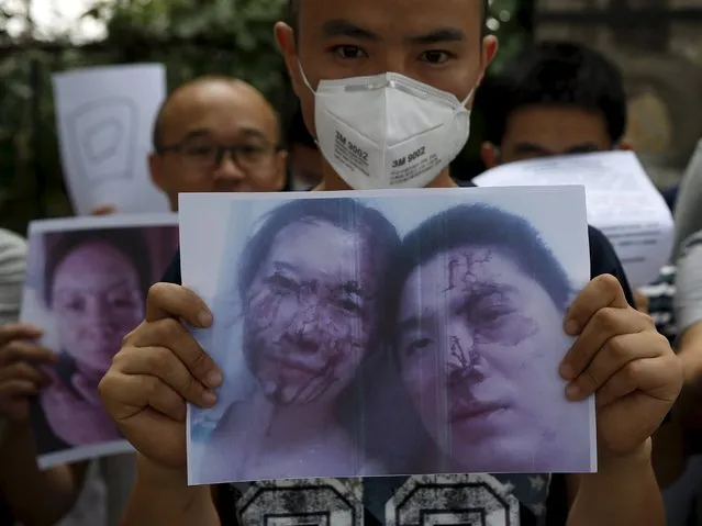 Residents evacuated from their homes after last week's explosions at Binhai new district, hold pictures of their injured neighbhors at a rally demanding government compensation outside the venue of the government officials' news conference in Tianjin, China, August 17, 2015. Some 6,300 people have been displaced by the blasts. Shockwaves were felt by residents in apartment blocks kilometres away in the city of 15 million people. (Photo by Kim Kyung-Hoon/Reuters)