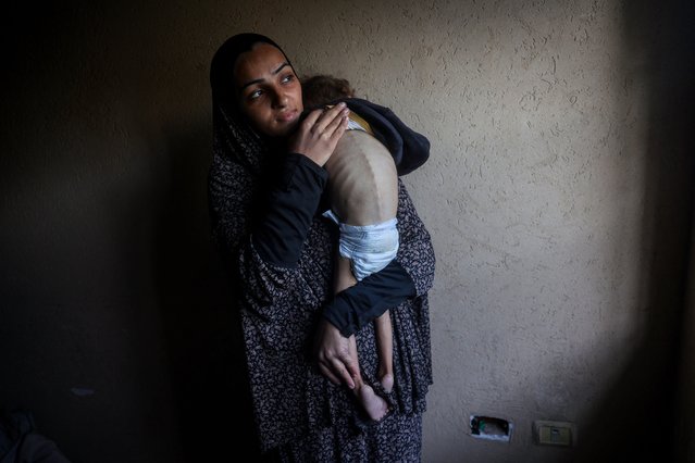 A Palestinian mother holds her five-year-old daughter suffering from malnutrition, at a shelter they live after being displaced by the war, in Deir el-Balah in the central Gaza Strip, on December 24, 2024, amid the ongoing war between Israel and the Palestinian militant group Hamas. (Photo by Eyad Baba/AFP Photo)
