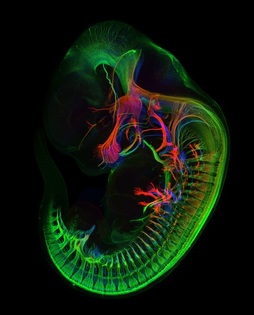 Mr. Zhong Hua, of Johns Hopkins University School of Medicine, took this image of the peripheral nerves (those outside of the brain) in an 11.5-day-old mouse embryo, magnified five times. (Photo by Zhong Hua)