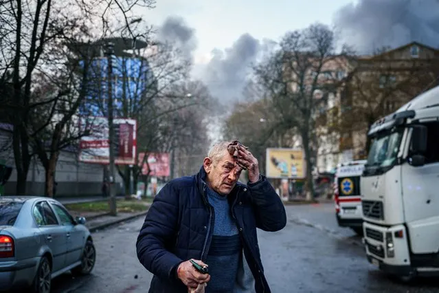 An injured man stands on a street after Russian shelling to Ukrainian city of Kherson on December 24, 2022, where five were killed and 20 injured. Ukrainian President Volodymyr Zelensky on December 24, 2022 blasted Russian “terror” after shelling left at least eight dead and 17 injured in Kherson city, which Kyiv's forces recaptured in November. (Photo by Dimitar Dilkoff/AFP Photo)