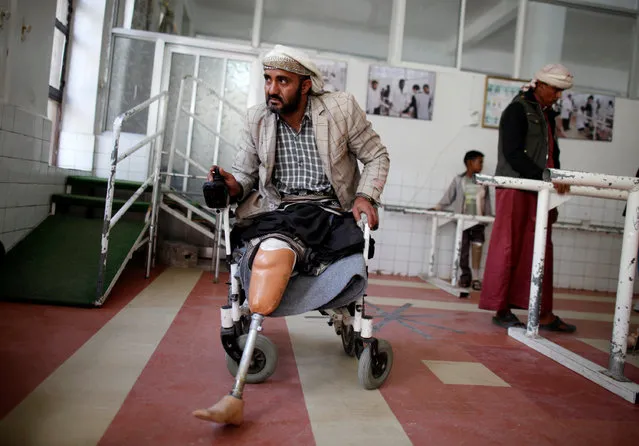 A Houthi fighter, who lost both his legs during recent clashes against government forces, waits at a prosthetic limb centre in Sanaa, Yemen January 16, 2017. (Photo by Khaled Abdullah/Reuters)