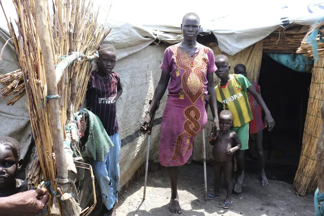 In this photo of Friday, June 2, 2017, Mary Nyakwas stands with her children outside her hut in Bentiu South Sudan. Mary lost her leg to a crocodile while hiding in the swamps, as she and her four children fled the fighting in her village. More than 1.2 million disabled people are being left behind in South Sudan's brutal civil war. The U.N and aid agencies are being told to step up, as those “with disabilities and older people find themselves at much greater risk of starvation or abuse”, a Human Rights Watch report said Wednesday. (Photo by Sam Mednick/AP Photo)