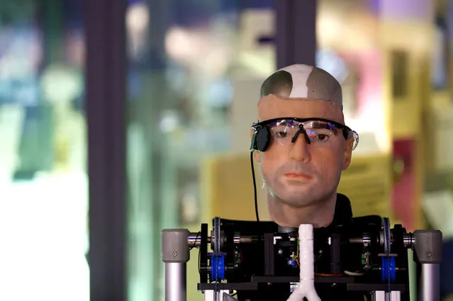 Bionic Man Has Fully Functional Mechanical Organs