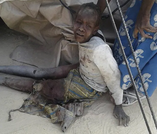 This handout image received courtesy of Doctors Without Border (MSF) on January 17, 2017, shows a wounded child after an air force jet accidentally bombarded a camp for those displaced by Boko Haram Islamists, in Rann, northeast Nigeria At least 52 aid workers and civilians were killed on January 17, 2017, when an air force jet accidentally bombed a camp in northeast Nigeria instead of Boko Haram militants, medical charity MSF said. (Photo by AFP Photo/Médecins sans Frontières)