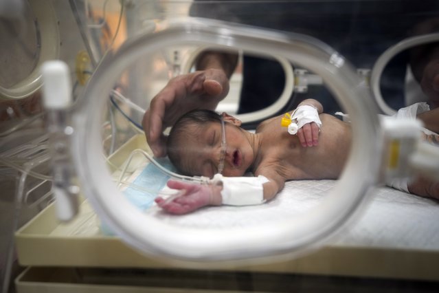 Ali al-Batran, a 20-day-old infant, lies in the intensive care unit with hypothermia at Al-Aqsa Martyrs Hospital in Deir al-Balah, central Gaza, Sunday, December 29, 2024. His twin brother, Jomaa, has died, as local health officials report at least three other infant deaths from the cold in recent weeks. (Photo by Abdel Kareem Hana/AP Photo)