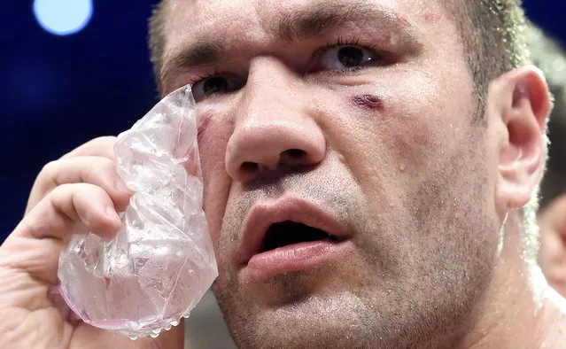 Challenger Bulgarian heavyweight boxer Kubrat Pulev applies an ice pack to his face after being knocked down by Ukrainian WBA, WBO, IBO and IBF heavyweight boxing world champion Vladimir Klitschko (not pictured) after their title fight in Hamburg, November 15, 2014. (Photo by Fabian Bimmer/Reuters)