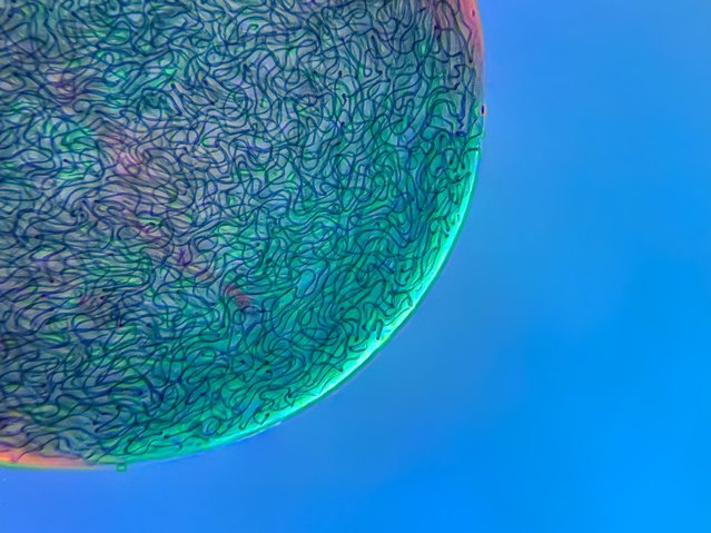17th place: filamentous strands of Nostoc cyanobacteria captured inside a gelatinous matrix. (4x objective lens magnification). (Photo by Martin Kaae Kristiansen/My Microscopic World/Nikon Small World Photomicrography 2021)