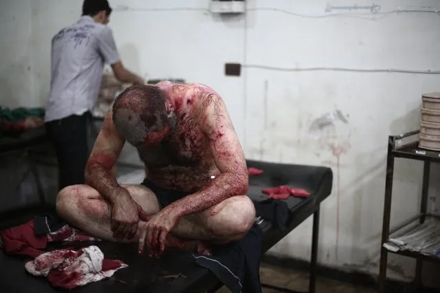 A wounded man sits on bed as he is treated at a makeshift hospital following reported shelling by Syrian government forces in Douma, northeast of Damascus, on August 3, 2014. At least 32 people were killed in Syrian regime air raids on two rebel-held towns near the capital. The rebel bastion of Douma has been besieged by regime forces for more than a year, and it has been the target of regular bombardment over past weeks. (Photo by Abd Doumany/AFP Photo)