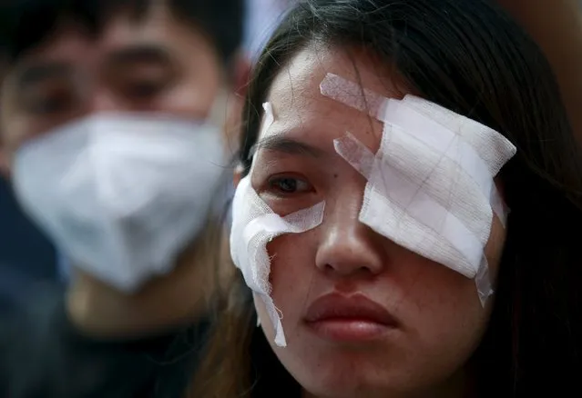 An injured resident evacuated from home after last week's explosions at Binhai new district takes part in a rally demanding government compensation outside the venue of the government officials' news conference in Tianjin, China, August 17, 2015. (Photo by Kim Kyung-Hoon/Reuters)