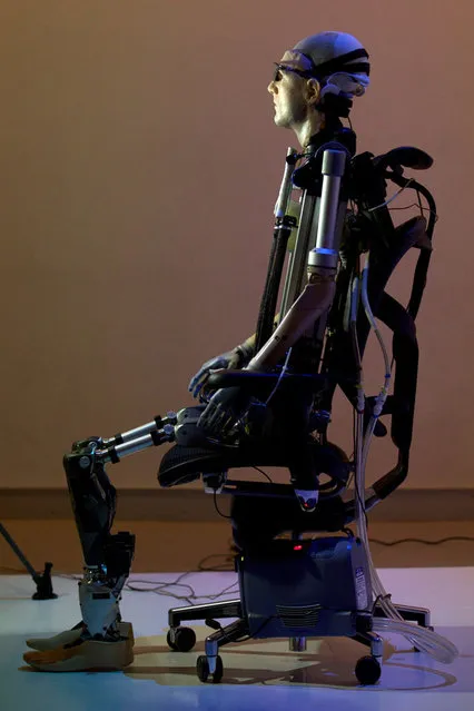 Bionic Man Has Fully Functional Mechanical Organs