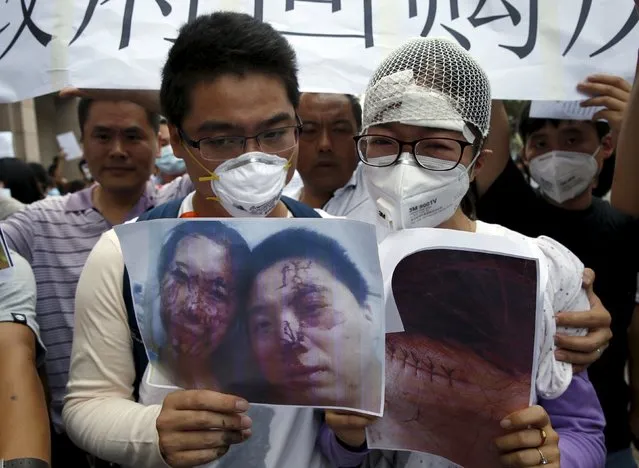 Injured residents evacuated from their homes after last week's explosions at Binhai new district, hold pictures showing their injuries at a rally demanding government compensation outside the venue of the government officials' news conference in Tianjin, China, August 17, 2015. (Photo by Kim Kyung-Hoon/Reuters)