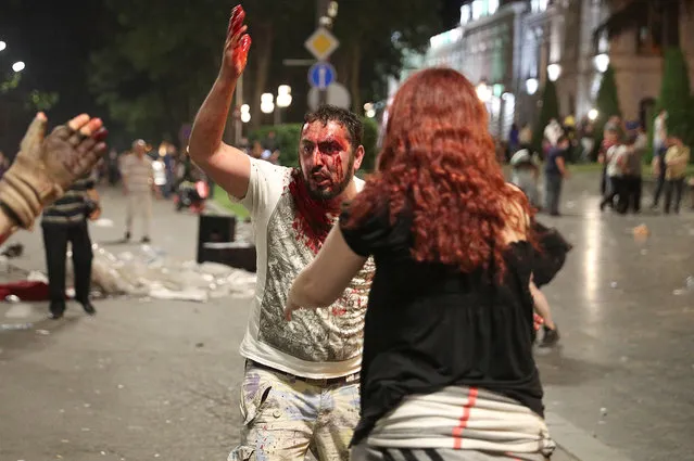 A man with blood on his face reacts after he was injured during a rally against a Russian lawmaker's visit in Tbilisi, Georgia on June 21, 2019. (Photo by Irakli Gedenidze/Reuters)