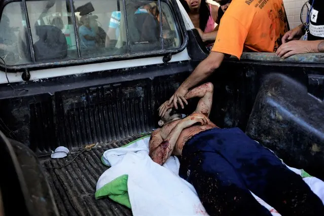 An injured man covered in blood arrives in the bed of a vehicle to Getulio Vargas Hospital after police raided Vila Cruzeiro favela of Rio de Janeiro, Brazil, Tuesday, May 24, 2022. (Photo by Bruna Prado/AP Photo)