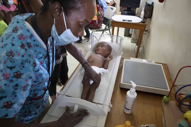 A baby suffering from malnutrition is measured at the Gheskio Center in Port-au-Prince, Haiti, Monday, November 21, 2022. Manuel Fontaine, director of UNICEF's Office of Emergency Programmes, visited the center on Monday. (Photo by Joseph Odelyn/AP Photo)