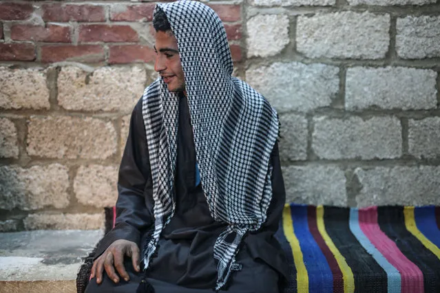 In this Wednesday, March 18, 2015 photo, Baskharoon Mounir, 15, poses for a photograph at his home in Tehna, a village in Minya, southern Egypt. Baskharoon lost his left arm to a cutting machine at a stone quarry in 2013 after working for only a month without safety equipment or training. (Photo by Mosa'ab Elshamy/AP Photo)