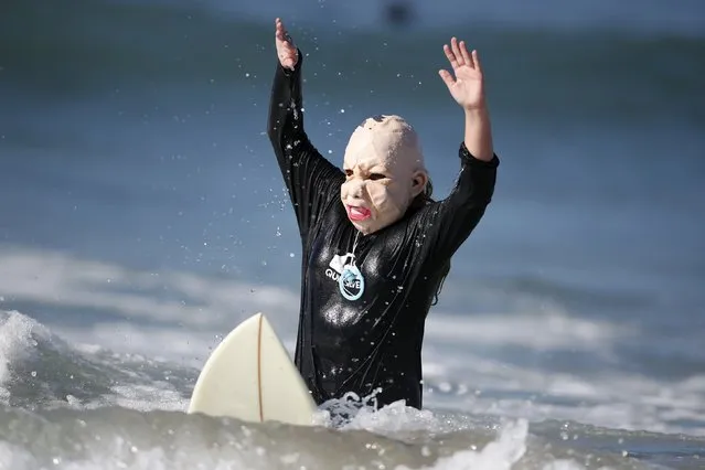 Joey Callhehan, 13, competes dressed as a baby during the ZJ Boarding House Haunted Heats Halloween Surf Contest in Santa Monica, California, United States, October 31, 2015. (Photo by Lucy Nicholson/Reuters)
