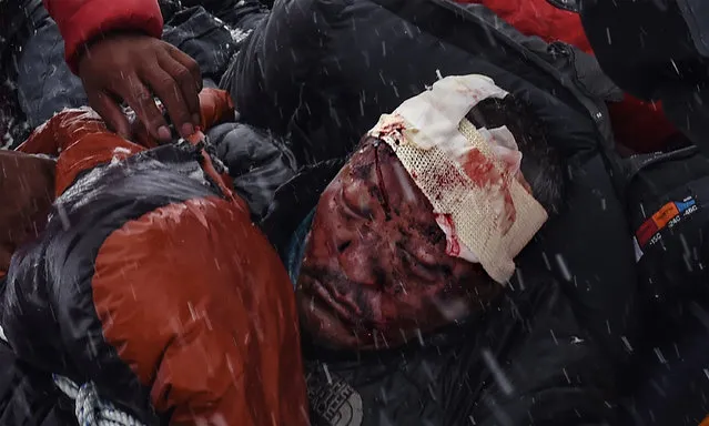 In this image released by World Press Photo titled “Avalanche, 25-27 April, Everest Base Camp, Nepal” by photograher Roberto Schmidt for AFP which won second prize Spot News stories category shows a man suffering from severe head trauma being bundled in a sleeping bag used as a makeshift stretcher while being taken by rescuers to a medical tent moments after the avalanche in Nepal, 25 April 2015. (Photo by Roberto Schmidt/AFP, World Press Photo via AP Photo)