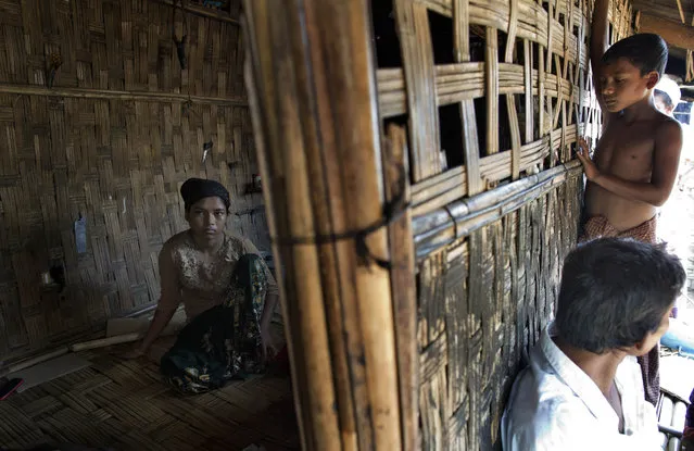 In this In this Tuesday, May 12, 2015, photo 17-year old Rorbiza rests at home of Dapaing, North of Sittwe, western Rakhine state, Myanmar after escaping from a human trafficking boat. (Photo by Gemunu Amarasinghe/AP Photo)