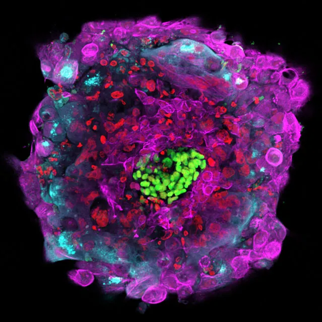 This microscope photo provided by The Rockefeller University shows a human embryo 12 days after fertilization in vitro, with different cell types marked by separate colors. Scientists have gotten their first good look at a crucial stage in the development of human embryos, a step that could help clear up mysteries about the early days of a person's life. (Photo by Gist Croft, Alessia Deglincerti, Ali H. Brivanlou/The Rockefeller University via AP Photo)