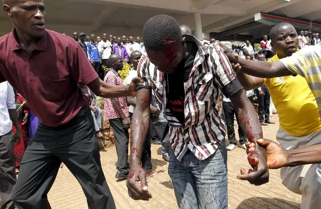 A supporter of Kenya's opposition Coalition for Reforms and Democracy (CORD), is assisted after he was injured in a confrontation during their rally at Uhuru Park grounds in a show of solidarity with teachers currently engaged in a national striker over a pay increase dispute, in capital Nairobi, September 23, 2015. (Photo by Thomas Mukoya/Reuters)