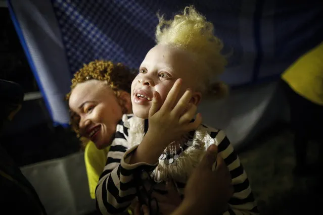 Eight-year-old albino girl Rebecca Zawadi plays with an woman prior to he fashion show during the Mr. & Miss Albinism East Africa contest in Nairobi, Kenya, 30 November 2018. Hudreds of abino men, women and children participated in the contest to raise awareness on discrimination and stigma against albinism in the region. (Photo by Dai Kurokawa/EPA/EFE)