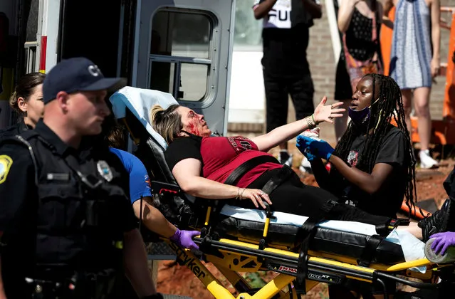 An injured protester is attended to during a rally against the death in Minneapolis police custody of George Floyd, in Columbia, South Carolina, U.S., May 30, 2020. (Photo by Sam Wolfe/Reuters)