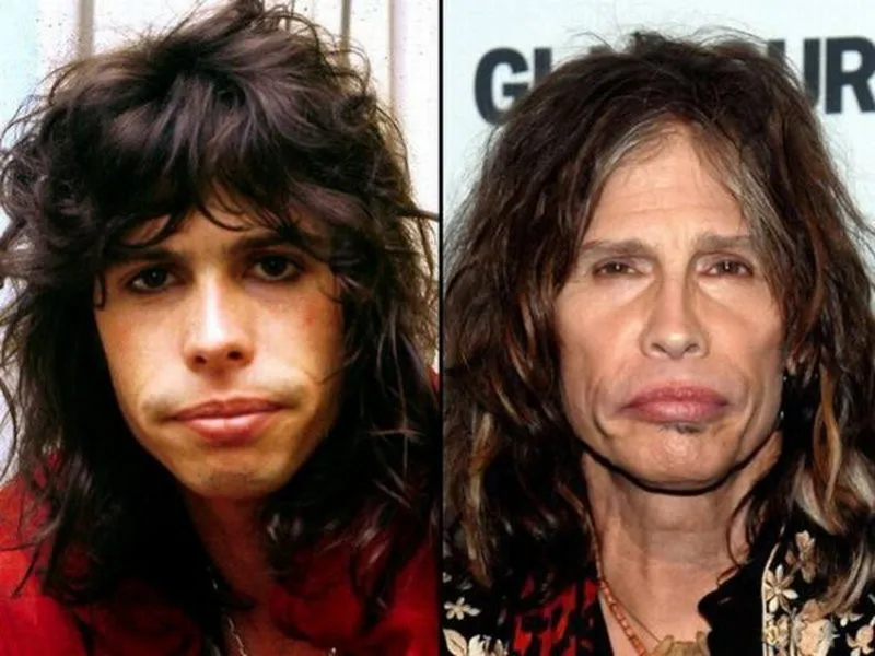 Rock Star Then and Now