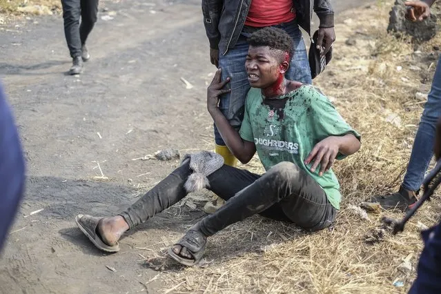A demonstrator sits after being wounded during a protest against the United Nations peacekeeping force (MONUSCO) deployed in the Democratic Republic of the Congo in Sake, some 15 miles (24 kms) west of Goma, Wednesday July 27, 2022. (Photo by Moses Sawasawa/AP Photo)