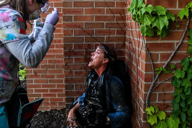 A medic protestor assists a member of the media after police started firing tear gas and rubber bullets near the 5th police precinct during a demonstration to call for justice for George Floyd, a black man who died while in custody of the Minneapolis police, on May 30, 2020 in Minneapolis, Minnesota. Curfews were imposed in major US cities Saturday as clashes over police brutality escalated across America with demonstrators ignoring warnings from President Donald Trump that his government would stop the violent protests “cold”. (Photo by Chandan Khanna/AFP Photo)