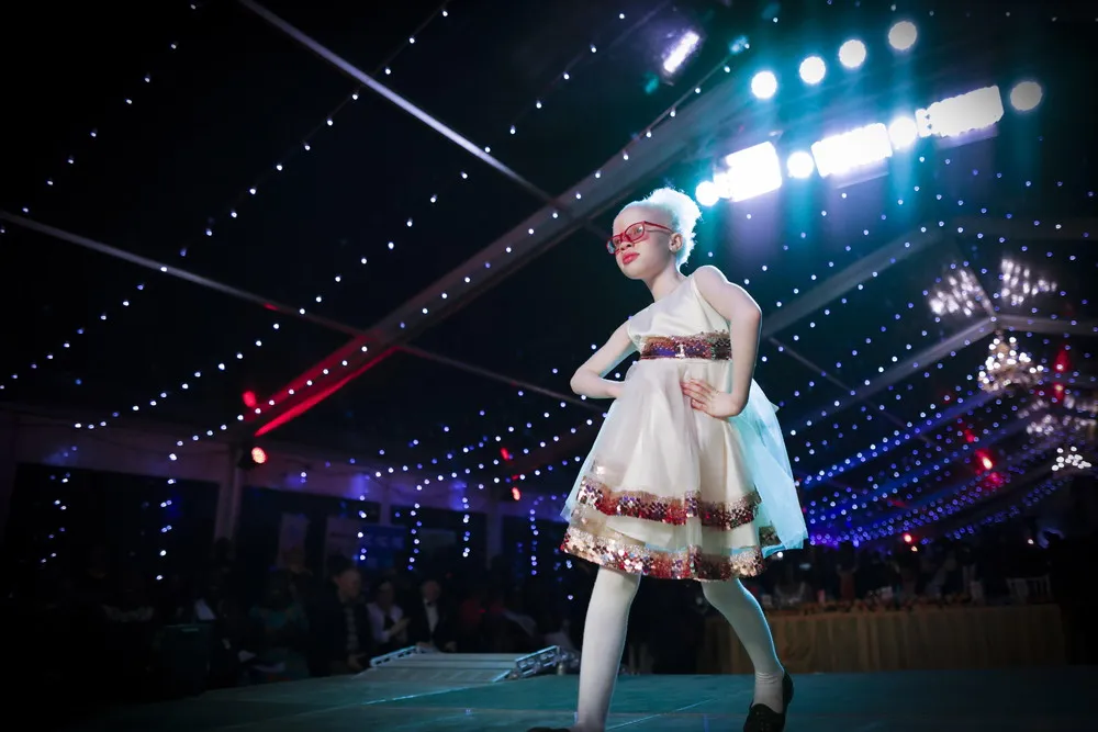 Mr. & Miss Albinism East Africa Contest in Nairobi