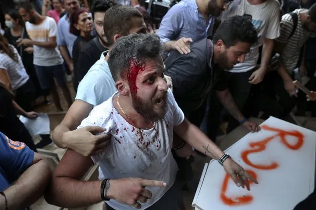 A relative of someone who was killed in last year's massive blast at Beirut's seaport bleeds during clashes with riot police as he and others try to storm the home of caretaker Interior Minister Mohamed Fehmi in Beirut, Lebanon, Tuesday, July 13, 2021. (Photo by Bilal Hussein/AP Photo)