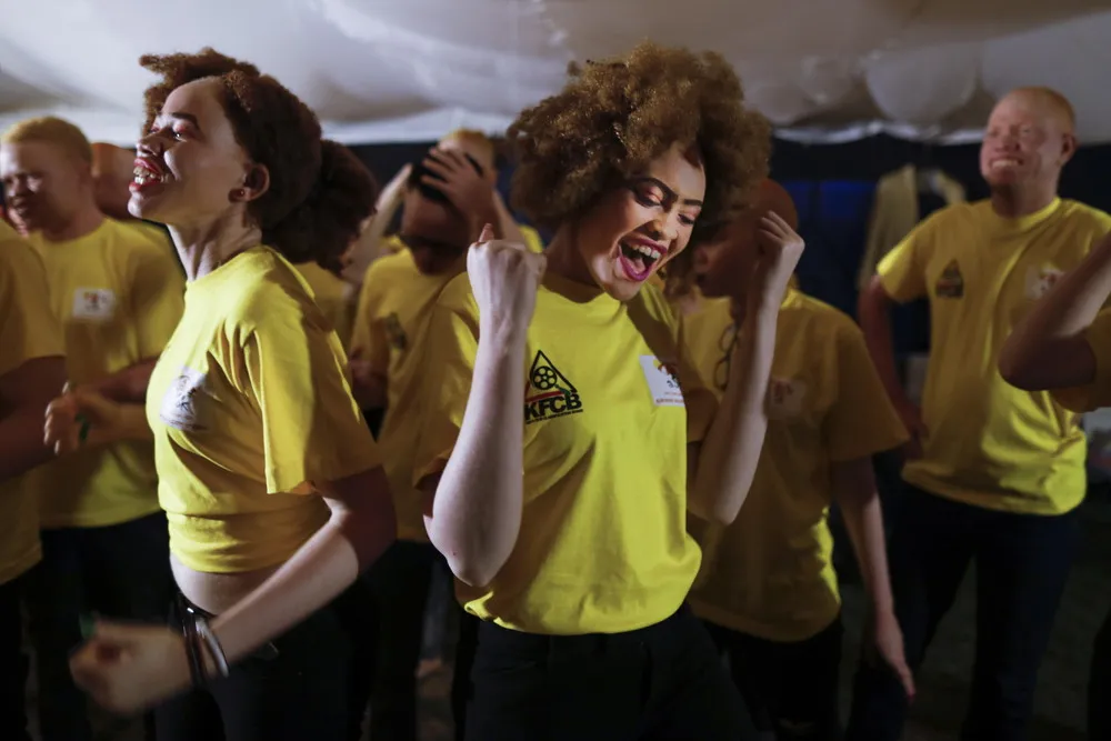 Mr. & Miss Albinism East Africa Contest in Nairobi