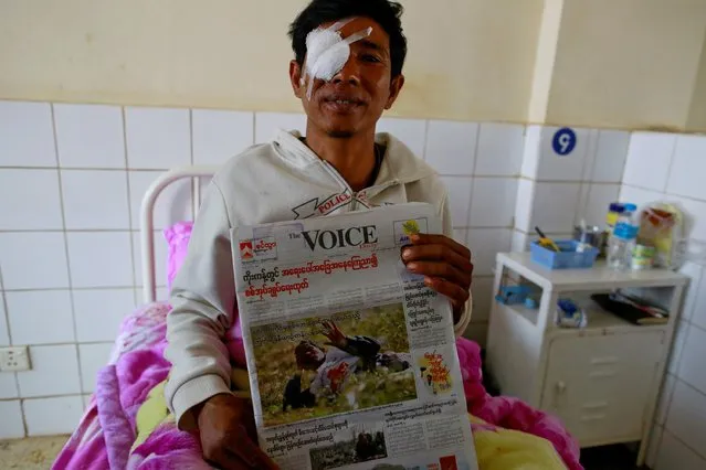 Zaw Min Htike 37, a volunteer driver from the Myanmar red cross society who was wounded in an attack on a red cross convoy, holds a newspaper featuring his picture on the frontpage, at a hospital in Lashio February 19, 2015. (Photo by Soe Zeya Tun/Reuters)