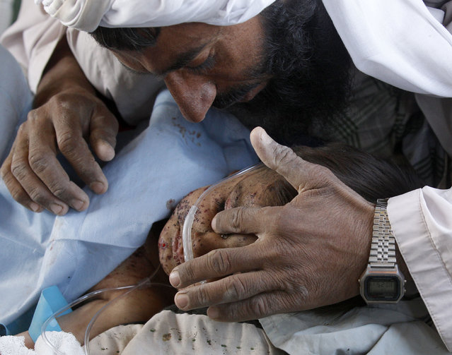 A father wipes a tear away from his child's face during a Medevac mission in southern Afghanistan's Helmand province November 13, 2010. The child was injured by an explosion. (Photo by Peter Andrews/Reuters)