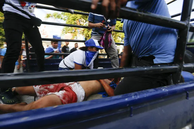 A man who was shot and wounded is carried on the back of a pick-up truck to get medical attention during a march against Nicaragua's President Daniel Ortega in Managua, Nicaragua, Wednesday, May, 30, 2018. Violence returned to protests against Nicaraguan President Daniel Ortega's government when riot police and government supporters confronted protesters during a mother's day march to commemorate those mothers who has lost their children during the ongoing protests. (Photo by Alfredo Zuniga/AP Photo)