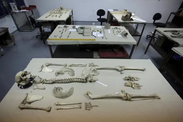 The remains of an unidentified person are arranged on a table at the forensic anthropology department of the Forensic Institute in San Salvador, July 21, 2015. (Photo by Jose Cabezas/Reuters)