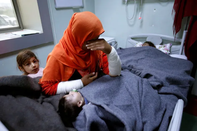 A mother reacts as her daughter Ranmea is treated for possible exposure to chemical weapons agents in a hospital west of Erbil in Mosul, Iraq, March 4, 2017. (Photo by Azad Lashkari/Reuters)