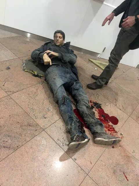In this photo provided by Georgian Public Broadcaster and photographed by Ketevan Kardava a man is wounded in Brussels Airport in Brussels, Belgium, after explosions were heard Tuesday, March 22, 2016. A developing situation left at least one person and possibly more dead in explosions that ripped through the departure hall at Brussels airport Tuesday, police said. All flights were canceled, arriving planes were being diverted and Belgium's terror alert level was raised to maximum, officials said. (Photo by Ketevan Kardava/AP Photo)