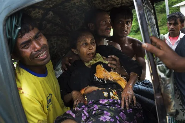 An injured elderly woman and her relatives rush to a hospital on an autorickshaw, near the border town of Kutupalong, Bangladesh, Monday, September 4, 2017. The Rohingya woman encountered a landmine that blew off the right leg while trying to cross into Bangladesh. (Photo by Bernat Armangue/AP Photo)