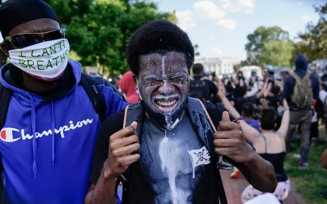 A demonstrator reacts after having milk poured into his eyes during as demonstrators gather to protest the death of George Floyd, Sunday, May 31, 2020, near the White House in Washington. Floyd died after being restrained by Minneapolis police officers. (Photo by Evan Vucci/AP Photo)