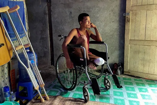 Ko Phyo, 24, a protester who lost a leg during an anti-coup protest, sits in his wheelchair at home on the outskirts of Yangon, Myanmar, April 24, 2021. The bullet that hit Ko Phyo severed three arteries. The soldier who fired the shot removed it with a knife, and a local policeman he knew took him to a military hospital, a journey that took more than two hours, he said. “I started feeling the pain and I couldn't bear it. I told them to cut off my leg immediately. They cut it on the seventh day”. (Photo by Reuters/Stringer)