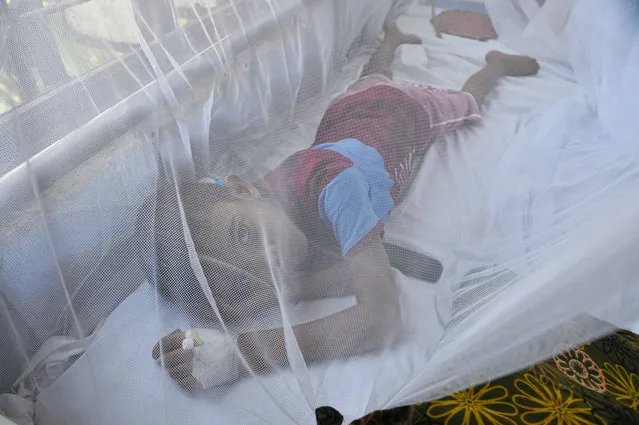 An eight-year-old child rests in hospital after contracting dengue fever in Sylhet, Bangladesh on October 18, 2022. (Photo by Md Rafayat Haque Khan/ZUMA Press Wire/Rex Features/Shutterstock)
