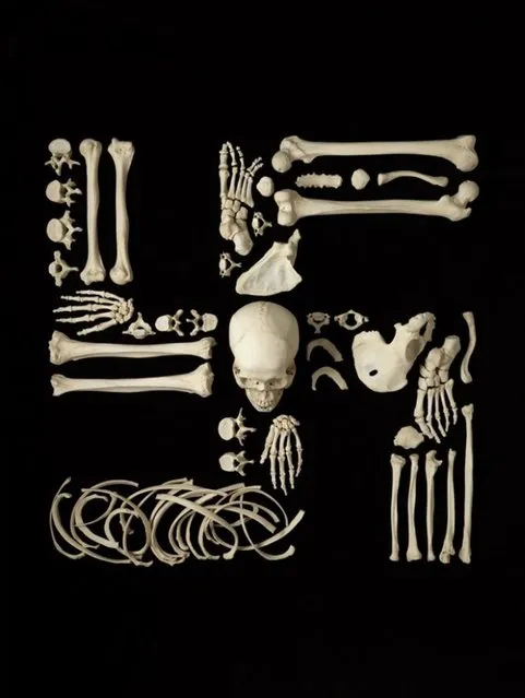Human Bone