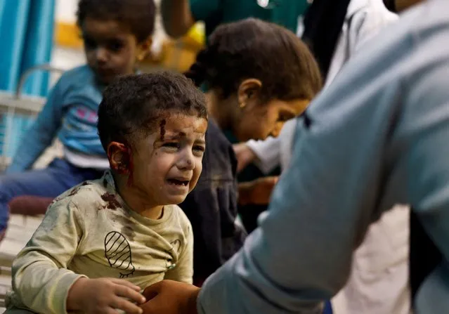 Palestinian children wounded in Israeli strikes amid the ongoing conflict between Israel and Palestinian group Hamas wait to receive treatment at Nasser hospital in Khan Younis in the southern Gaza Strip on November 12, 2023. (Photo by Mohammed Salem/Reuters)