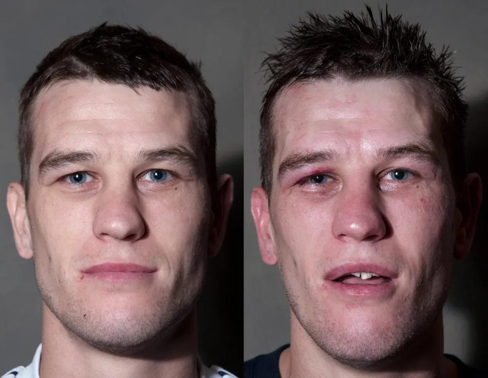 Boxing Before and After by Howard Schatz