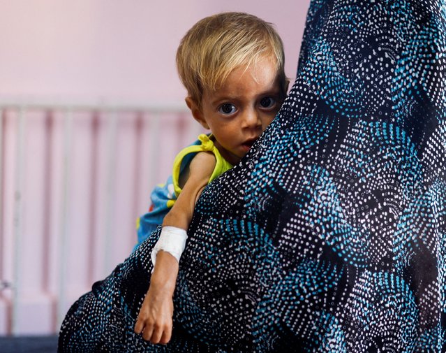 A child looks on at Nasser hospital in Khan Younis, in the southern Gaza Strip on July 8, 2024. (Photo by Mohammed Salem/Reuters)